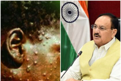 JP Nadda called meeting on increasing case of monkeypox 2 more cases surfaced in Pakistan